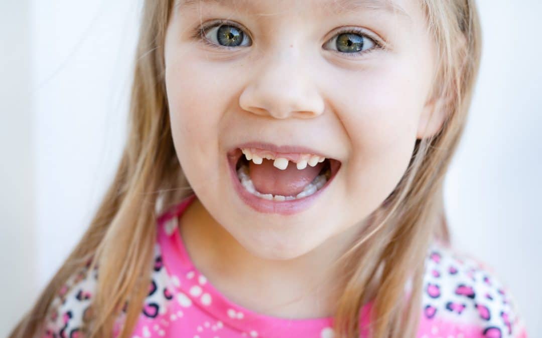 What Are the Signs That Your Child May Need Braces in West Reading, PA?