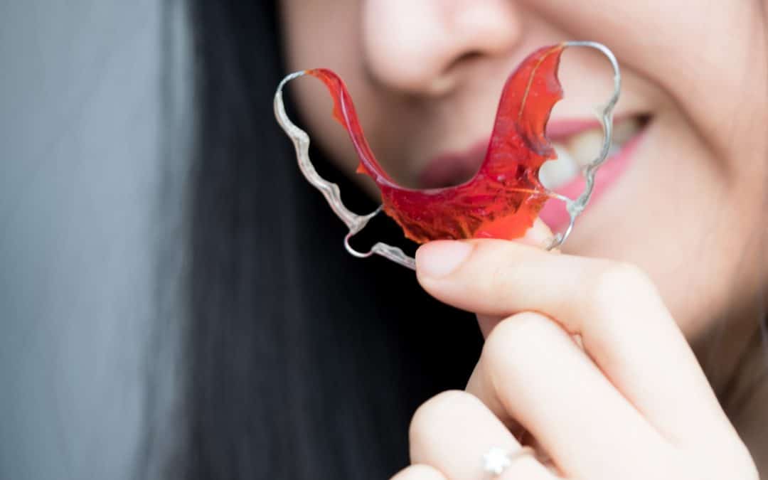 Are Retainers Necessary After Orthodontic Treatment in West Reading, PA?